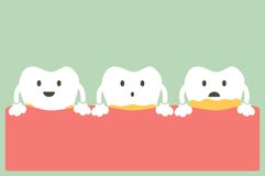 Periodontal choroba z plakietą lub winnikiem ilustracja wektor Periodontal choroba z plakietą lub winnikiem ilustracja wektor