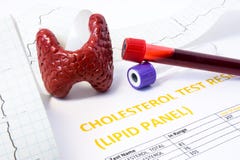 Photo de concept thyroïde et de cholestérol Le modèle de la glande thyroïde, tubes à essai avec le sang pour le diagnostic de lip images libres de droits Photo de concept thyroïde et de cholestérol Le modèle de la glande thyroïde, tubes à essai avec le sang pour le diagnostic de lip images libres de droits