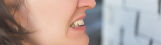 Photo Of Crooked Woman Teeth Royalty Free Stock Photos