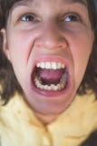 Photo Of Crooked Woman Teeth Royalty Free Stock Photos