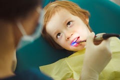Photopolymer seal child, pediatric dentistry without pain stock photos Photopolymer seal child, pediatric dentistry without pain stock photos