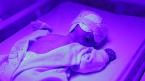 Phototherapy para recién nacido metrajes Phototherapy para recién nacido metrajes