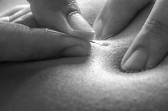 Physitoterapist/chiroprator que faz uma massagem traseira osteopathy fotografia de stock Physitoterapist/chiroprator que faz uma massagem traseira osteopathy fotografia de stock