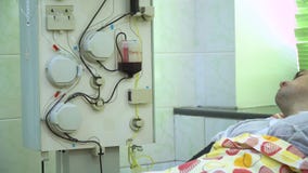 Plasmapheresis Limpieza de la sangre del paciente a trav?s del dispositivo El proceso de quitar plasma de sangre de almacen de metraje de vídeo Plasmapheresis Limpieza de la sangre del paciente a trav?s del dispositivo El proceso de quitar plasma de sangre de almacen de metraje de vídeo