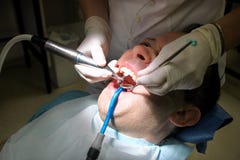 Polissage dentaire de dent Dents nettoyant, hygiène dentaire Le dentiste est polissage des dents patientes avec la brosse dentair photos libres de droits Polissage dentaire de dent Dents nettoyant, hygiène dentaire Le dentiste est polissage des dents patientes avec la brosse dentair photos libres de droits