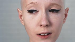 Portrait d'une femme triste et déprimée souffrant du cancer regardant dans l'appareil-photo banque de vidéos Portrait d'une femme triste et déprimée souffrant du cancer regardant dans l'appareil-photo banque de vidéos
