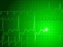 Priorità bassa di EKG royalty illustrazione gratis Priorità bassa di EKG royalty illustrazione gratis