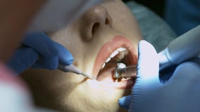 Procedimiento médico del dentista de los dientes que pulen con la limpieza del depósito y del odontolith dentales fotos de archivo libres de regalías Procedimiento médico del dentista de los dientes que pulen con la limpieza del depósito y del odontolith dentales fotos de archivo libres de regalías
