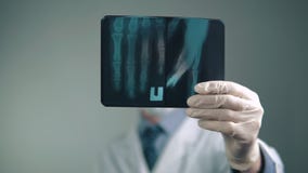 Promieniowanie rentgenowskie ręka rozważa lekarką w szpitalu zbiory wideo Promieniowanie rentgenowskie ręka rozważa lekarką w szpitalu zbiory wideo