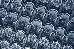 Prova di tomografia del cranio della testa umana di neurologia di scansione del cervello o dei raggi x di RMI fotografie stock Prova di tomografia del cranio della testa umana di neurologia di scansione del cervello o dei raggi x di RMI fotografie stock