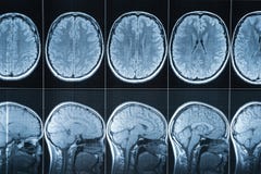 Proyección de imagen de resonancia magnética de la cabeza, MRI fotos de archivo Proyección de imagen de resonancia magnética de la cabeza, MRI fotos de archivo