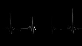 Pulse Line of Heartbeat on Black Background. Cardiac Arrest. Realistic Animated Heart Rhythm Cardiogram Medical Research