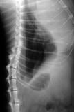 Radiografía de los pulmones del gato fotografía de archivo libre de regalías Radiografía de los pulmones del gato fotografía de archivo libre de regalías