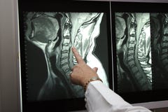 Radiology professional pointing to mri