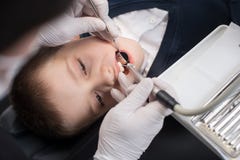 Ragazzo con la bocca aperta durante il trattamento di perforazione al dentista pediatrico in clinica dentaria fotografia stock libera da diritti Ragazzo con la bocca aperta durante il trattamento di perforazione al dentista pediatrico in clinica dentaria fotografia stock libera da diritti