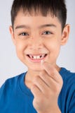 Rapaz pequeno que mostra a dentes de bebê o fim desdentado que espera acima os dentes novos fotografia de stock royalty free Rapaz pequeno que mostra a dentes de bebê o fim desdentado que espera acima os dentes novos fotografia de stock royalty free