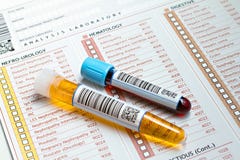 Rapporto medico con i tubi di anima e di urina Immagine Stock Rapporto medico con i tubi di anima e di urina Immagine Stock