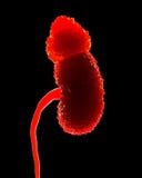 Rein Polycystic, illustration illustration de vecteur Rein Polycystic, illustration illustration de vecteur
