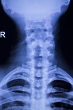 Ricerca dei raggi x delle spalle della spina dorsale del collo del cranio Immagini Stock Ricerca dei raggi x delle spalle della spina dorsale del collo del cranio Immagini Stock