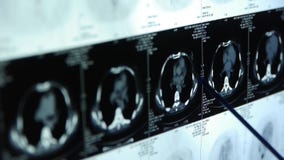 Ricerca di animale-ct del seno di studio di medico, raggi x medici video d archivio Ricerca di animale-ct del seno di studio di medico, raggi x medici video d archivio
