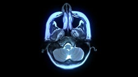 Ricerca di Mri Ricerca di Mri