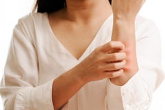 Risco da mão das mulheres o comichão no conceito do braço, dos cuidados médicos e da medicina imagens de stock Risco da mão das mulheres o comichão no conceito do braço, dos cuidados médicos e da medicina imagens de stock