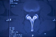 Risonanza magnetica medica del bacino della spina dorsale delle anche Fotografia Stock Libera da Diritti Risonanza magnetica medica del bacino della spina dorsale delle anche Fotografia Stock Libera da Diritti