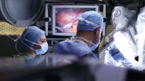 Robotic Surgery. Medical robot - Stock Footage
