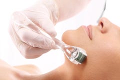 Roller microneedle mesotherapy