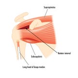 The shoulder muscles surrounding the rotator cuff