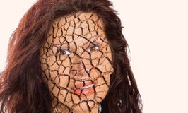 Mature woman with dry cracked skin stock photos Mature woman with dry cracked skin stock photos