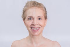 Before and after skin treatment