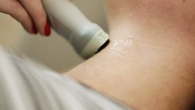 Sluit omhoog Schildklier Kenmerkend in Medisch Centrum Jonge Vrouw die het Onderzoek van de Halsultrasone klank doen bij het Ziek stock footage Sluit omhoog Schildklier Kenmerkend in Medisch Centrum Jonge Vrouw die het Onderzoek van de Halsultrasone klank doen bij het Ziek stock footage