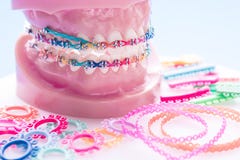 Sluit omhoog tandartshulpmiddelen en orthodontisch model royalty-vrije stock fotografie Sluit omhoog tandartshulpmiddelen en orthodontisch model royalty-vrije stock fotografie