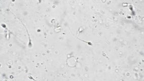 Sperma Aus Dem Sperma Eines Mittleren Mannes Unter Einer Vergrößerung Des  Mikroskops 1000 Mal Stock Video - Video von mikrobiologie, ausbildung:  278869277