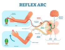 Spinal Reflex Arc anatomical scheme, vector illustration, with stimulus, sensory neuron, motor neuron and muscle tissue. vector illustration Spinal Reflex Arc anatomical scheme, vector illustration, with stimulus, sensory neuron, motor neuron and muscle tissue. vector illustration
