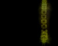 Spinal roentgenogram Stock Images Spinal roentgenogram Stock Images