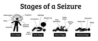 seizure epilepsy seizures postictal phases tonic clonic fases aura phasen sequestro depicts leremy occurs fasi ergreifung stadien controlling generalized navigationen