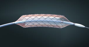 Stent e catetere per impianto e circolazione sanguigna sostenente nei vasi sanguigni royalty illustrazione gratis Stent e catetere per impianto e circolazione sanguigna sostenente nei vasi sanguigni royalty illustrazione gratis