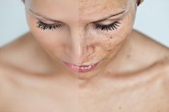 Before and after sun damage Stock Photos Before and after sun damage Stock Photos