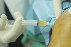 Surgeon and male patient injection human growth factors stock photos Surgeon and male patient injection human growth factors stock photos