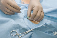Surgeon Manipulating A Flexible Catheter Stock Images Surgeon Manipulating A Flexible Catheter Stock Images