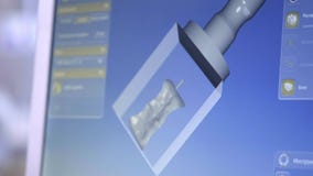 tand- digitalt modellera återställande 3D modell 3d av tänder, avlästa tänder av patienten Doktorn är att studera lager videofilmer tand- digitalt modellera återställande 3D modell 3d av tänder, avlästa tänder av patienten Doktorn är att studera lager videofilmer
