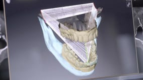 tand- digitalt modellera återställande 3D modell 3d av tänder, avlästa tänder av patienten Doktorn är att studera stock video tand- digitalt modellera återställande 3D modell 3d av tänder, avlästa tänder av patienten Doktorn är att studera stock video