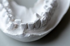 Tandmodell för utbildning i laboratorium arkivfoton Tandmodell för utbildning i laboratorium arkivfoton