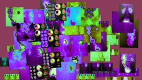 Radiological violet color diagnostic collage