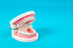 Tooth model with metal wire dental braces royalty free stock photos Tooth model with metal wire dental braces royalty free stock photos