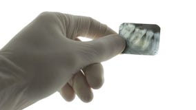 Tooth x-ray in hand