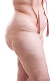 Torso Of A Woman With Obesity Royalty Free Stock Photo
