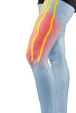 Traitement de physiothérapie avec la bande thérapeutique pour la douleur dans la jambe image stock Traitement de physiothérapie avec la bande thérapeutique pour la douleur dans la jambe image stock